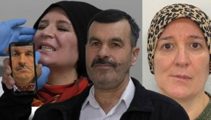 Çene ağrısı çekip, yüz asimetrileri bozulmuştu... Sebebini öğrenince hayatlarının şokunu yaşadılar: İnsan içine çıkamıyordum
